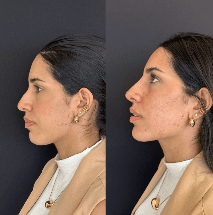 Resultado natural e harmonioso