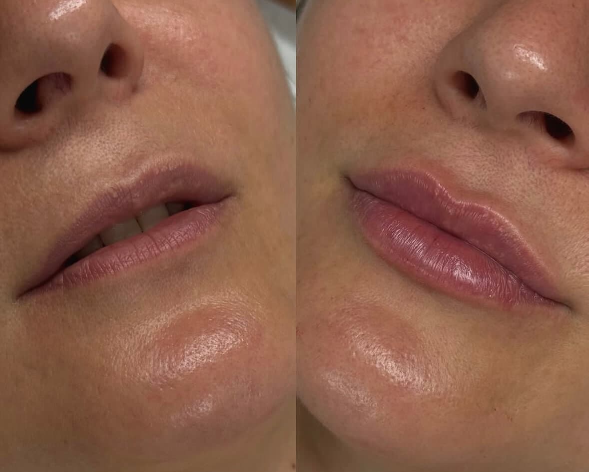Equilíbrio e beleza facial