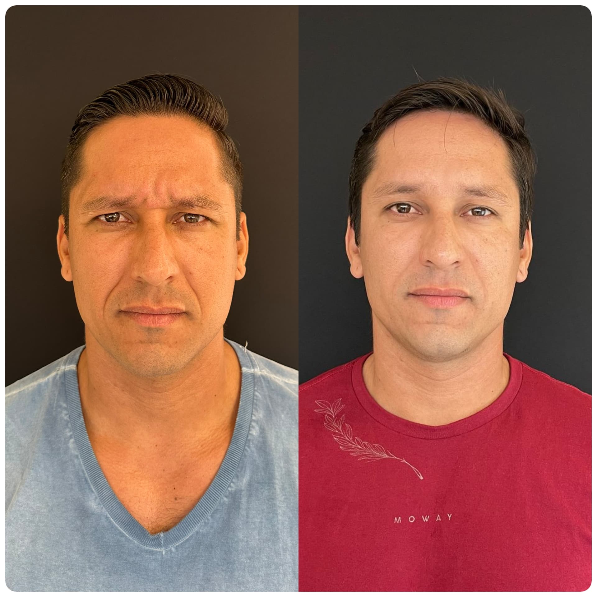 Transformação facial harmoniosa