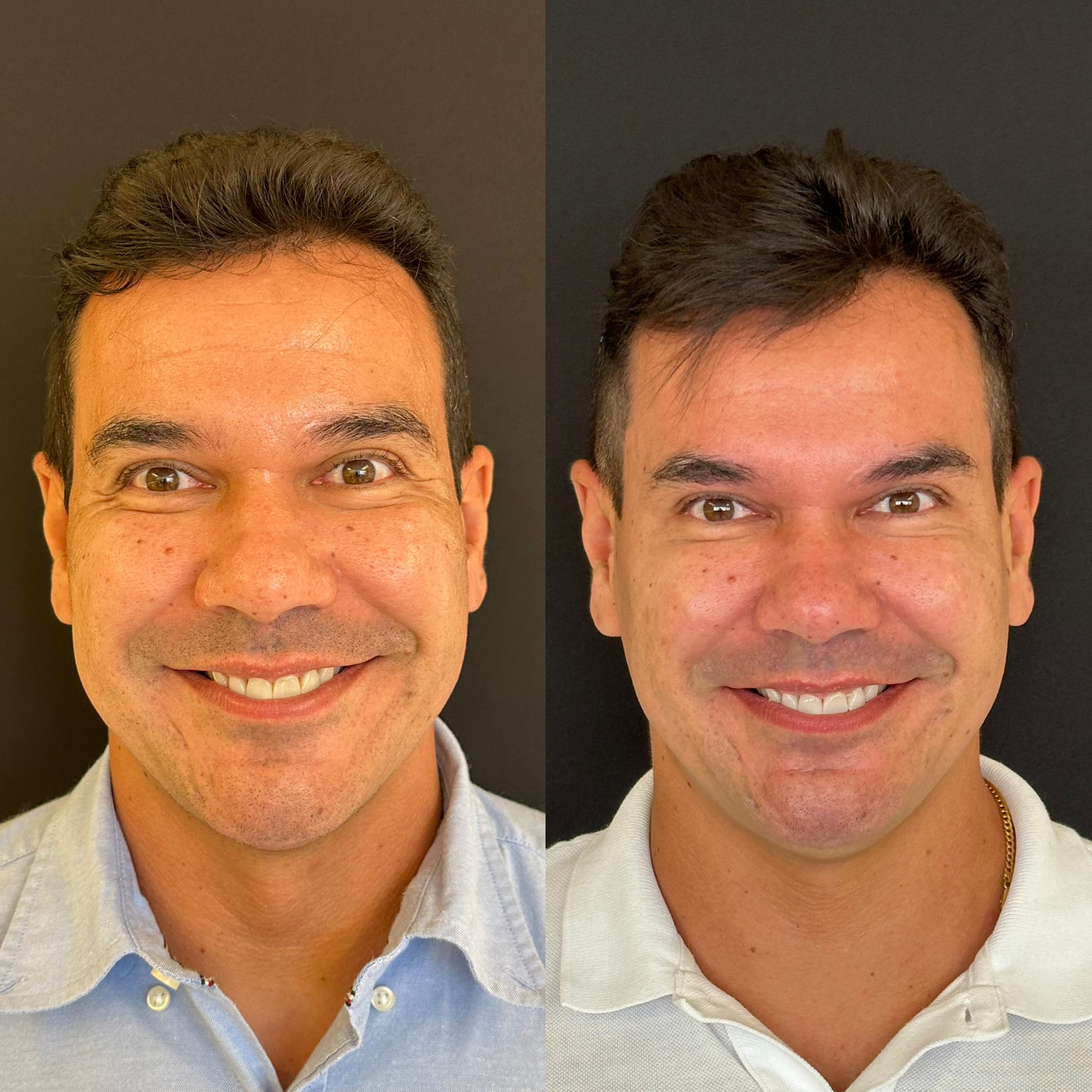 Rejuvenescimento natural