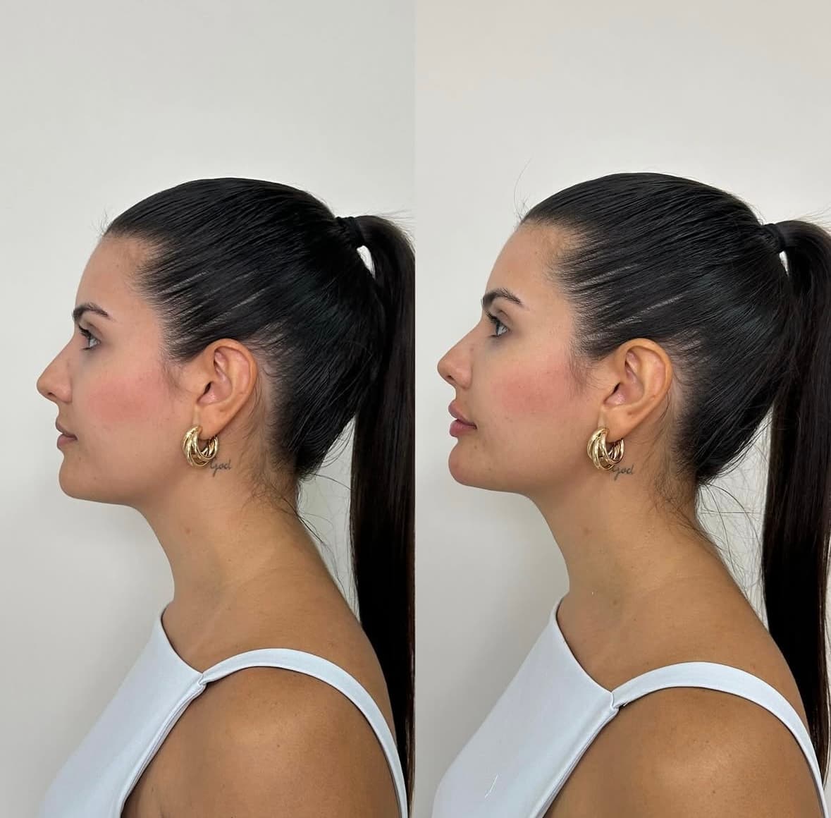 Beleza facial realçada