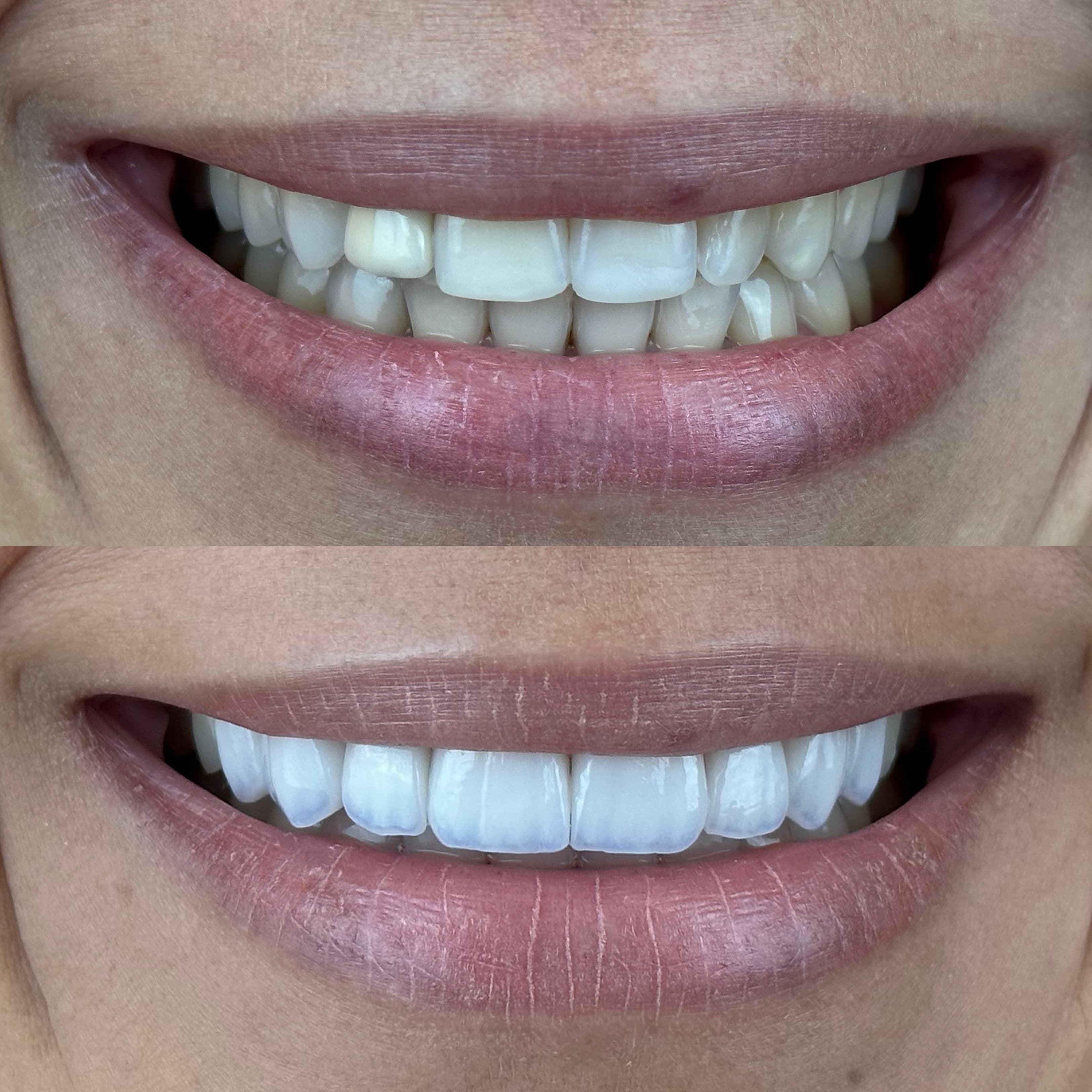 Sorriso dos sonhos realizado